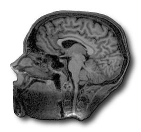 [Image of Iain's Brain]