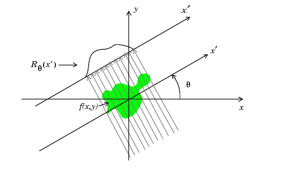 Radon transform