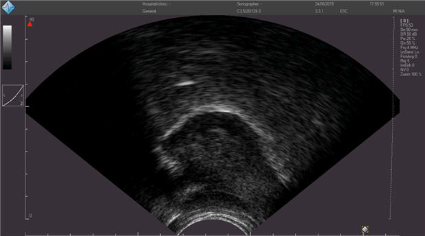 Ultrasound image of a soprano's tongue